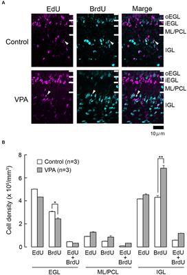 Induction of cerebellar cortical neurogenesis immediately following valproic acid exposure in ferret kits